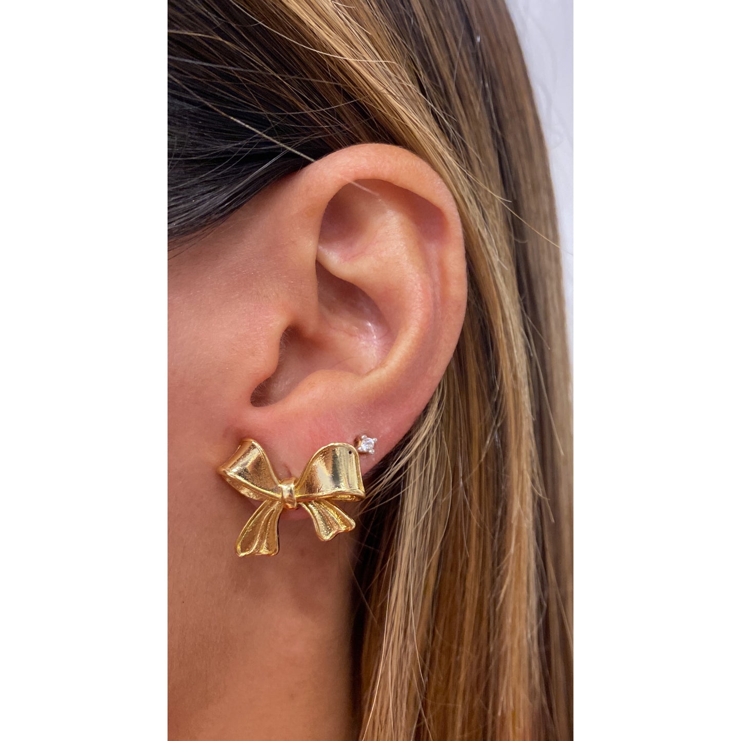 Aretes NEPA