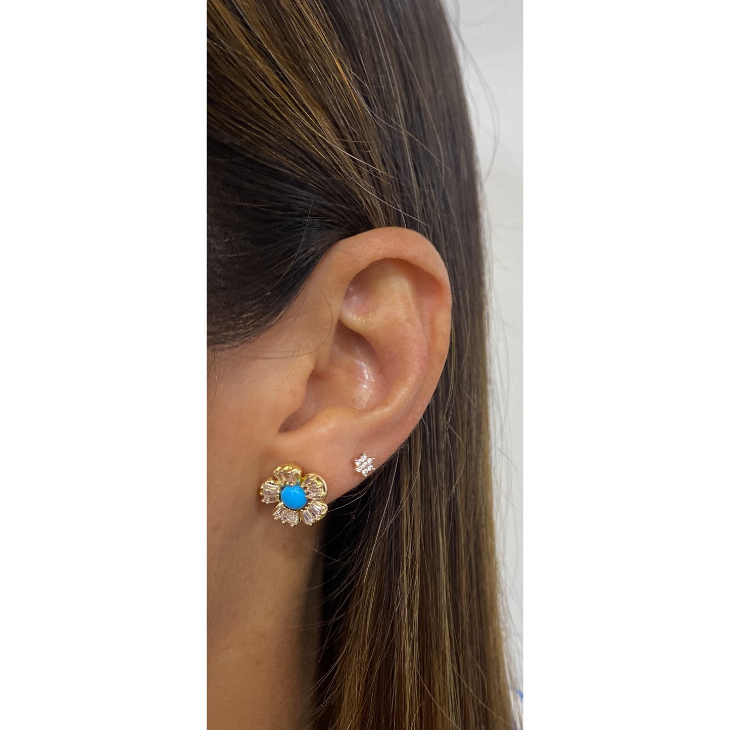 Aretes UNET