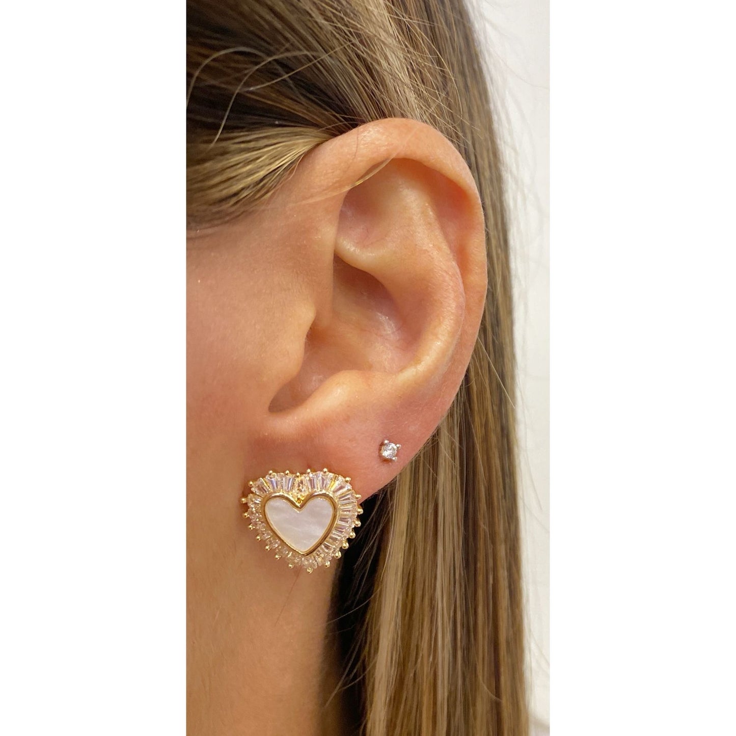 Aretes ZOLU
