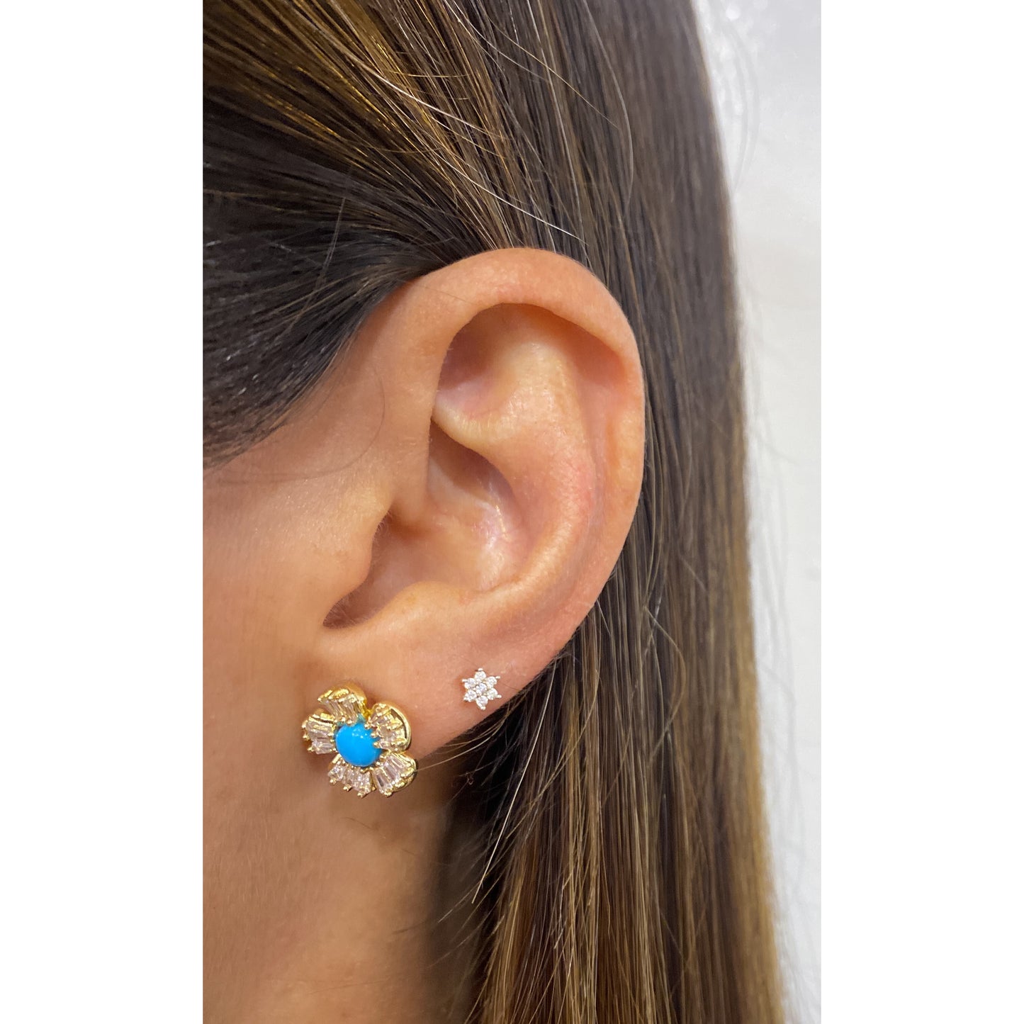 Aretes UNET