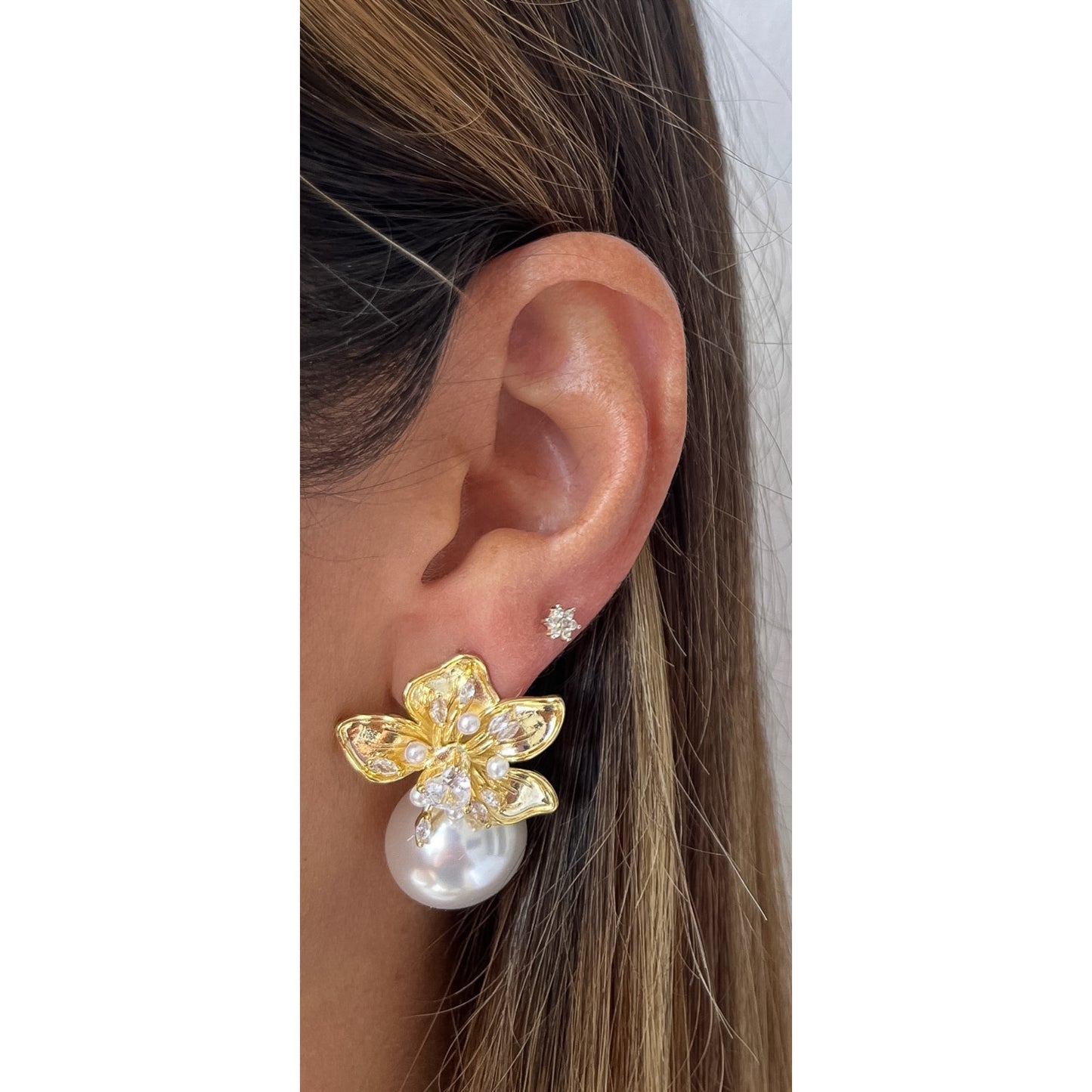 Aretes ZORTI